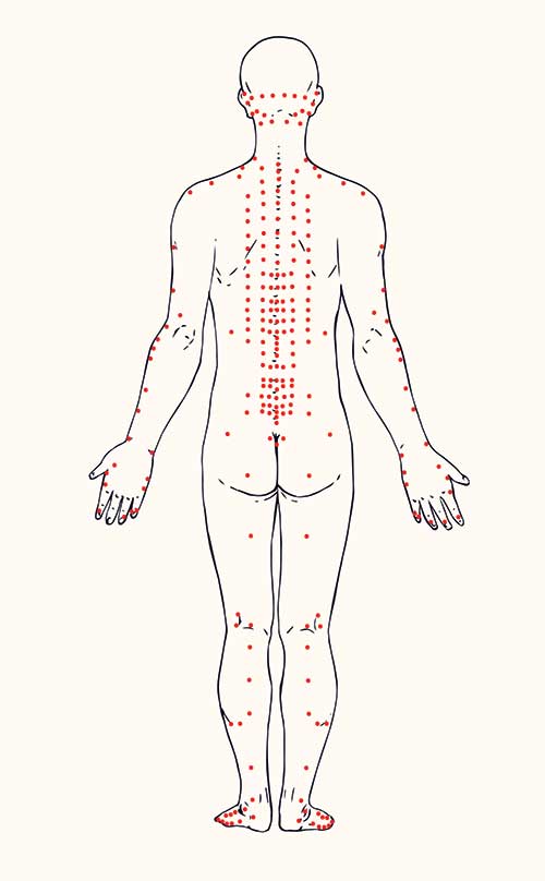 acupuncture points diagram