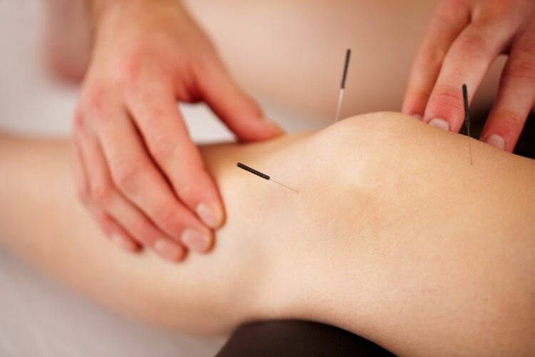 acupuncture-sports-injuries-rehab